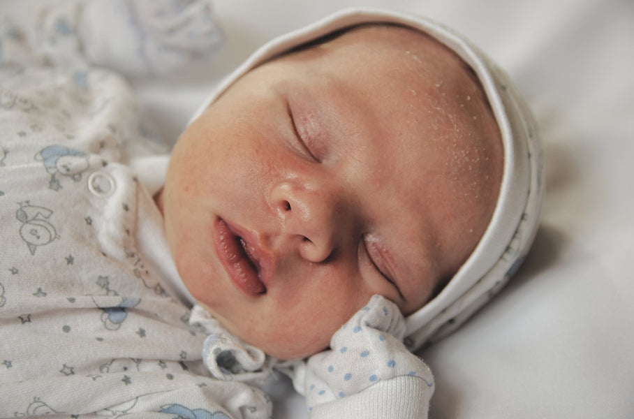 Tips on How to Manage Your Baby's Eczema