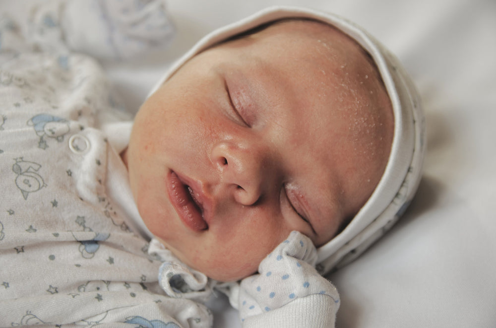 Tips on How to Manage Your Baby's Eczema